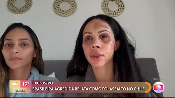 Brasileira agredida durante roubo no Chile diz que lutou com criminosos…